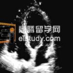国大和新科研要研究心脏衰竭背后的基因谜团？